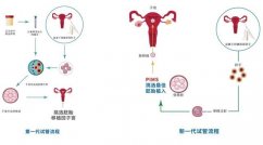 新一代试管婴儿技术发布，活产率提