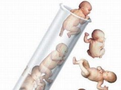 哈尔滨市三代试管婴儿可以筛选性别吗？需要花费多少钱？