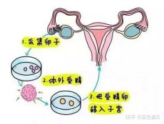 盘锦市三代试管婴儿可以筛选性别吗？需要花费多少钱？