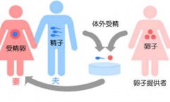 重庆江津区第三代试管成功率高不高？